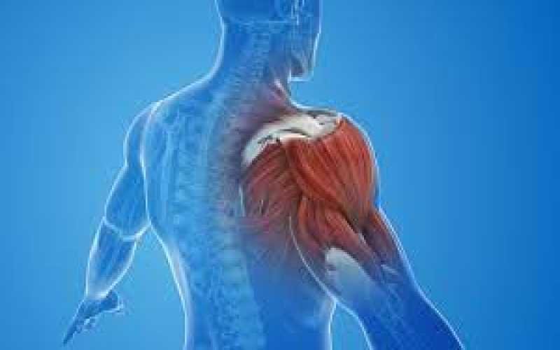 Frozen Shoulder