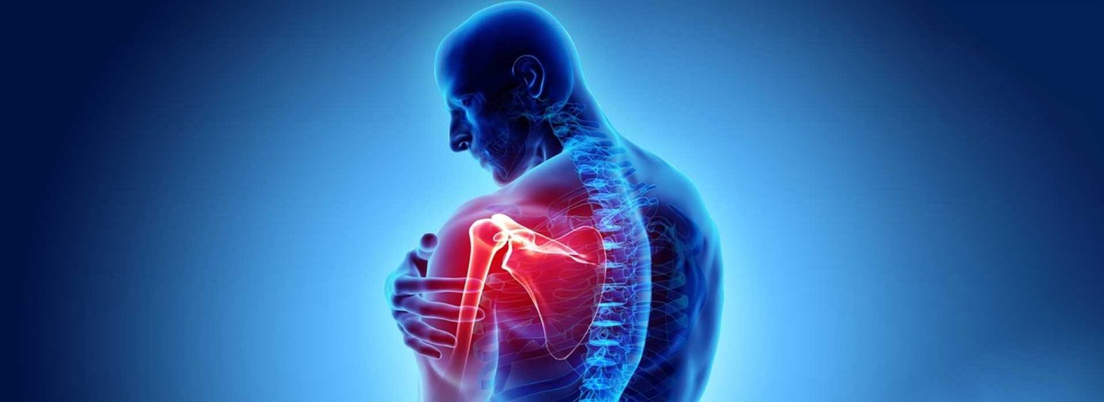 Shoulder Pain