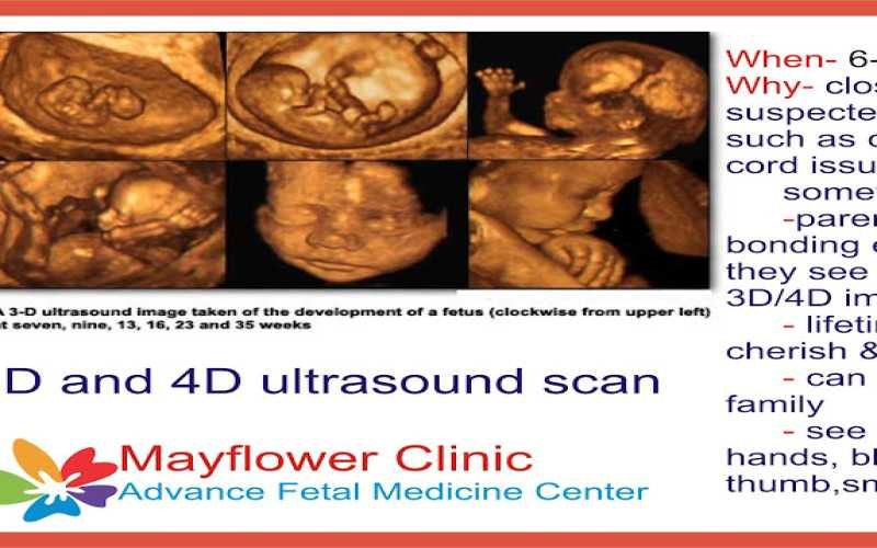 3D and 4D scanner for gynecologist?