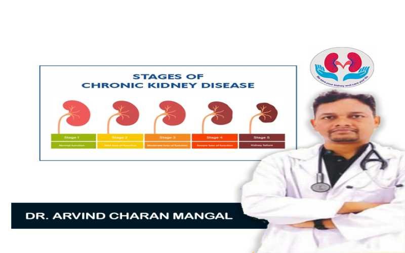 Are there stages of chronic kidney disease?