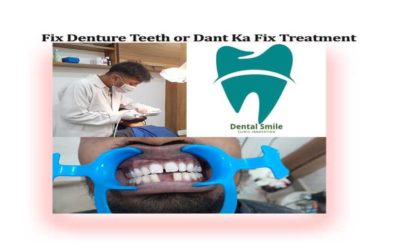 Fix Denture Teeth or Dant ka fix Treatment