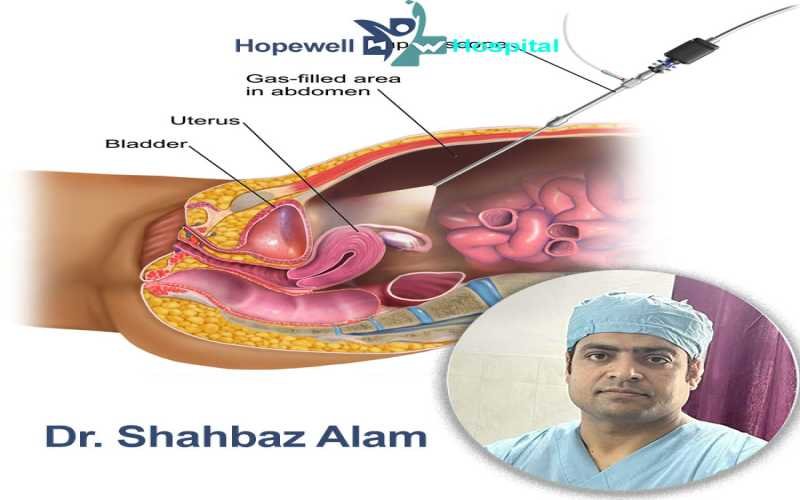 The Leading Laparoscopic Surgeon in Ranchi