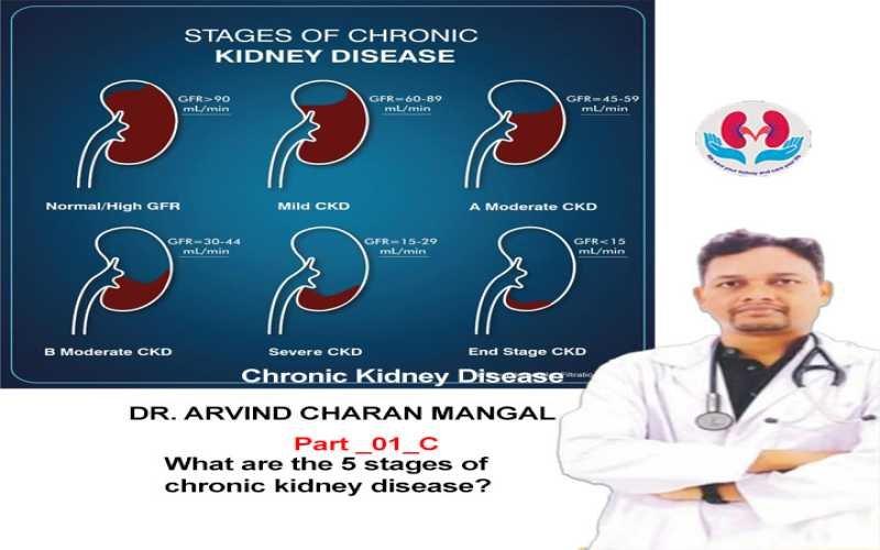 What are the five stages of chronic kidney disease? (Overviews_Part_01_C)