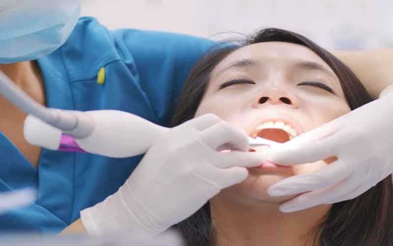 Ultrasonic Teeth Cleaning