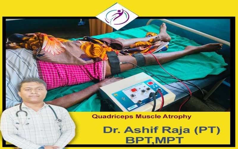 what is Quadriceps muscle atrophy?