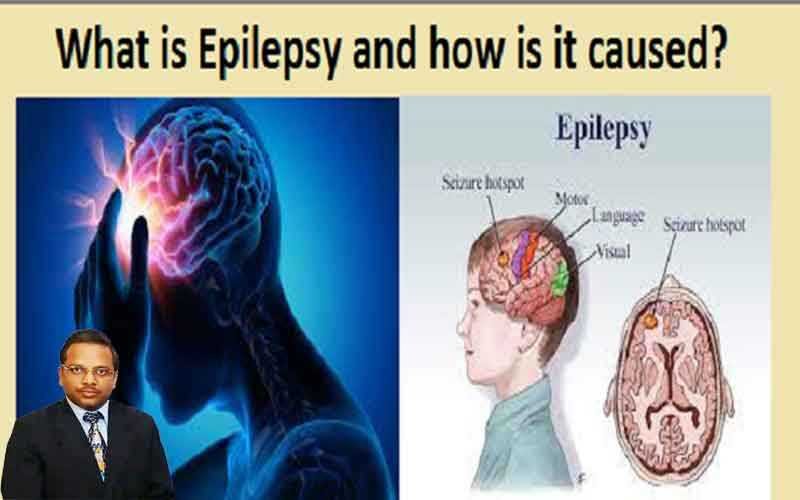epilepsy / मिरगी