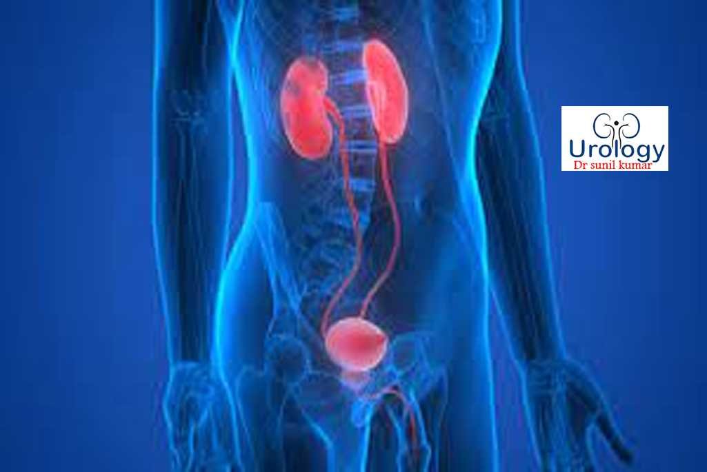 Urological Cancer Treatment